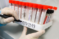Российские ученые получили перспективные вещества для лечения коронавируса